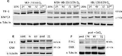 <b>Biological Strategies Validation and Genetic Strategies Validation.</b>Knockdown Validated: FIH-1/HIF-1AN Antibody [NB100-428] - (C) Cytoplasmic FIH-1 (lower band) and MMP14 expression levels in both aerobic and hypoxic conditions in the 3 cell lines. (E) siRNA targeting FIH-1 was used to assess whether FIH-1 had any effect on CAIX expression in MCF-7 cells cultured in 0.5% O2 conditions. cont, control. m, transfection reagent alone. scr, scrambled siRNA. pool, mixture of 4 siRNAs targeting FIH-1. 21, single siRNA targeting FIH-1. (F) FIH-1 and CAIX expression levels in aerobic MCF-7 cells treated with either siRNA against FIH-1 alone, or both 400 uM CoCl2 and siRNA together for 24, 48 and 72h. Image collected and cropped by CiteAb from the following publication (//pubmed.ncbi.nlm.nih.gov/28476026/) licensed under a CC-BY license.